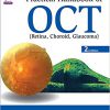 Practical Handbook of OCT: (Retina, Choroid, Glaucoma) 2nd Edition-Original PDF