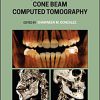 Interpretation Basics of Cone Beam Computed Tomography 2nd Edition-Original PDF
