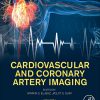 Cardiovascular and Coronary Artery Imaging: Volume 1 – 1st Edition – Retail PDF