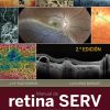Manual de Retina SERV. 2nd Edition-True PDF
