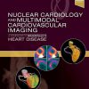 Nuclear Cardiology and Multimodal Cardiovascular Imaging: A Companion to Braunwald’s Heart Disease 1st Edition- Retails PDF