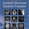 Imaging of Central Nervous System Tumors First Edition-EPUB+Converted PDF