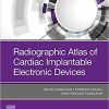 Radiographic Atlas of Cardiac Implantable Electronic Devices 1st Edition-True PDF