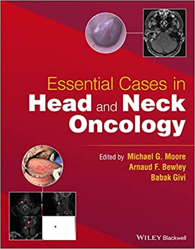 Essential Cases in Head and Neck Oncology -Original PDF