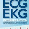 ECG / EKG Interpretation: A Systematic Approach to Read a 12-Lead ECG and Interpreting Heart Rhythms in 15 Seconds or less Without Memorization -EPUB+AZW+Converted PDF