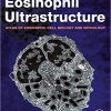 Eosinophil Ultrastructure: Atlas of Eosinophil Cell Biology and Pathology  1st Edition-True PDF