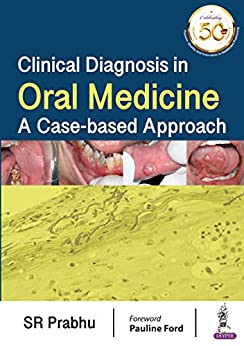 Clinical Diagnosis in Oral Medicine: A Case-based Approach -Original PDF