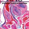 Arteriosclerosis, Thrombosis, and Vascular Biology July 2021 – Volume 41, Issue 7 Journal-PDF