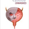 Cystitis Unmasked -Original PDF