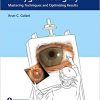 The Art of Pterygium Surgery: Mastering Techniques and Optimizing Results -EPUB