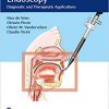 Drug-Induced Sleep Endoscopy: Diagnostic and Therapeutic Applications -EPUB