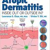 Atopic Dermatitis: Inside Out or Outside In 1st Edition-True PDF (Toc & Index)