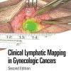 Clinical Lymphatic Mapping in Gynecologic Cancers 2nd Edition-True PDF