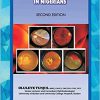 The Atlas of Retinal Diseases in Nigerians -Original PDF