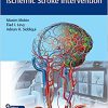 Video Atlas of Acute Ischemic Stroke Intervention -Original PDF