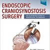 Endoscopic Craniosynostosis Surgery: An Illustrated Guide to Endoscopic Techniques 1st Edition-True PDF