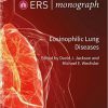 Eosinophilic Lung Diseases: 94 (ERS Monograph)-EPUB