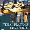 Tibial Plateau Fractures 1st Edition-True PDF