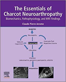 The Essentials of Charcot Neuroarthropathy: Biomechanics, Pathophysiology, and MRI Findings -Original PDF