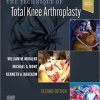 The Technique of Total Knee Arthroplasty 2nd Edition-Original PDF