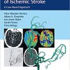 Endovascular Management of Ischemic Stroke: A Case-Based Approach -EPUB