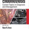 Endometriosis: Current Topics in Diagnosis and Management 1st Edition-Original PDF