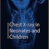 Chest X-ray in Neonates and Children -Original PDF