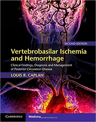Vertebrobasilar Ischemia and Hemorrhage: Clinical Findings, Diagnosis and Management of Posterior Circulation Disease 2nd Edition-Original PDF