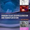 Principles and Practice of Ovarian Tissue Cryopreservation and Transplantation -Original PDF