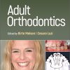 Adult Orthodontics 2nd Edition-Original PDF