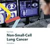 Fast Facts: Non-Small-Cell Lung Cancer -Original PDF