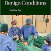 Hysterectomy for Benign Conditions -Original PDF