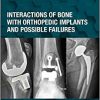 Interactions of Bone with Orthopedic Implants and Possible Failures (Orthopedic Implants and Biomaterials) 1st Edition-True PDF