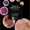 Atlas of Dermoscopy: Third Edition -Original PDF
