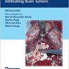 Video Atlas of Neurophysiological Monitoring in Surgery of Infiltrating Brain Tumors -Original PDF