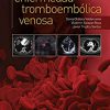 Compendio de enfermedad tromboembólica venosa (Spanish Edition) -Original PDF