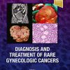 Diagnosis and Treatment of Rare Gynecologic Cancers-Original PDF