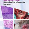 Head and Neck Cancer: Hallmarks of The Inflammation Ecosystem-Volume 2 -EPUB