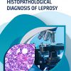 Histopathological Diagnosis Of Leprosy -Original PDF