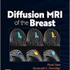 Diffusion MRI of the Breast 1st Edition-Original PDF