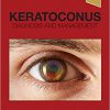 Keratoconus: Diagnosis and Management 1st Edition-Original PDF