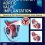 Transcatheter Aortic Valve Implantation 1st Edition-Original PDF