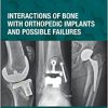 Interactions of Bone with Orthopedic Implants and Possible Failures (Orthopedic Implants and Biomaterials) -Original PDF