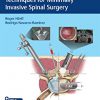 Essential Step-by-Step Techniques for Minimally Invasive Spinal Surgery -Original PDF
