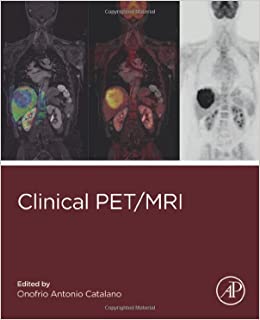 Clinical PET/MRI 1st Edition-True PDF