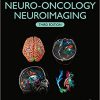 Handbook of Neuro-Oncology Neuroimaging 3rd Edition-Original PDF