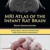MRI Atlas of the Infant Rat Brain: Brain Segmentation -Original PDF
