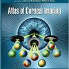 Atlas of Corneal Imaging 3rd Edition-Original PDF