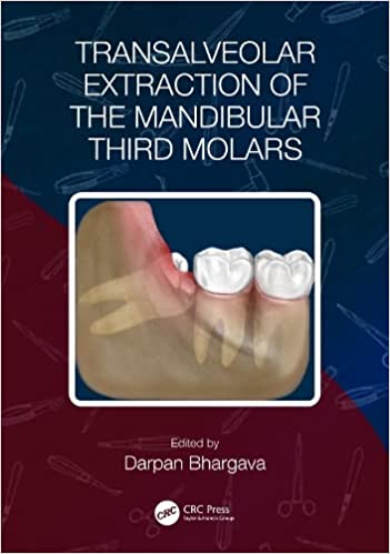 Transalveolar Extraction of the Mandibular Third Molars 1st Edition-Original PDF