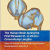 The Human Brain during the First Trimester 21- to 23-mm Crown-Rump Lengths: Atlas of Human Central Nervous System Development, Volume 4 -Original PDF